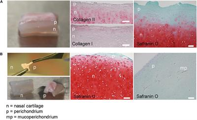 Biomarker Signatures of Quality for Engineering Nasal Chondrocyte-Derived Cartilage